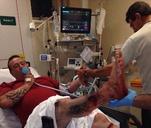 عکس: انفجار خونین سیگار الکترونیکی! (+18) 